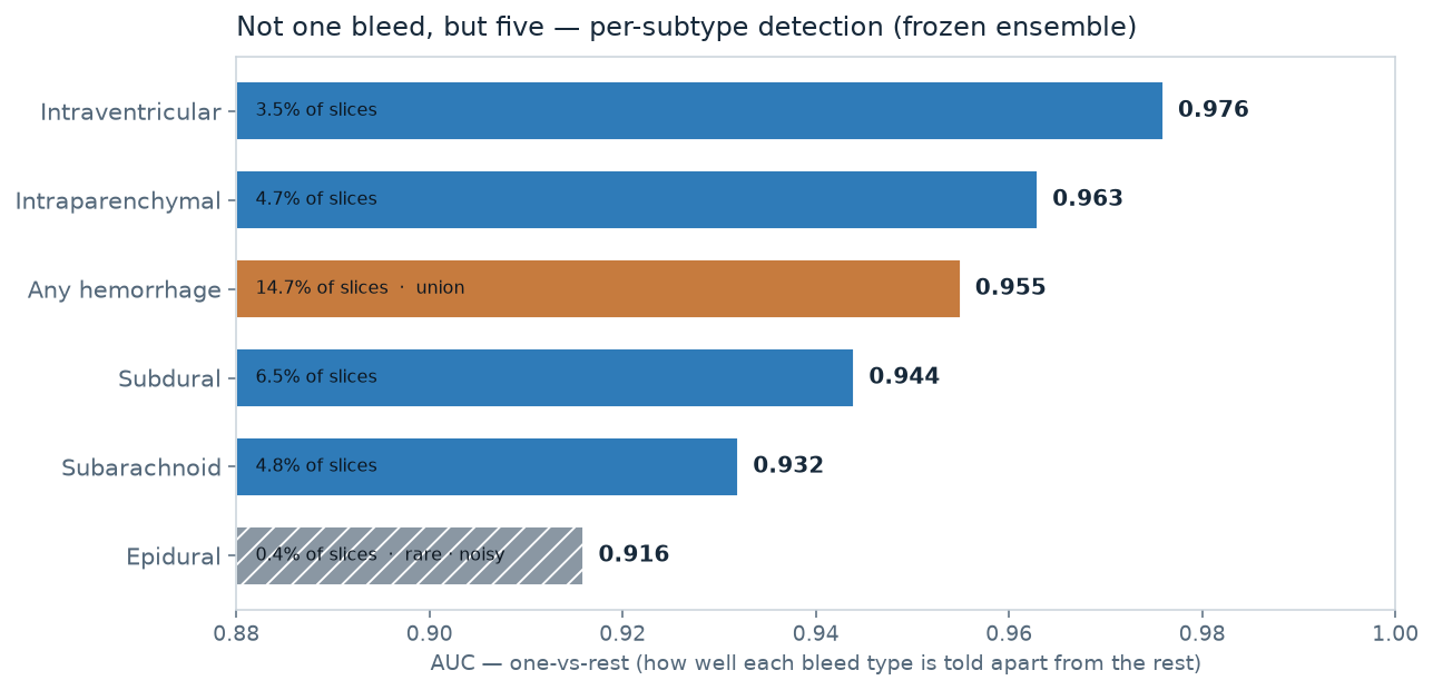Per-type detection AUC for the five haemorrhage types, frozen selected ensemble
